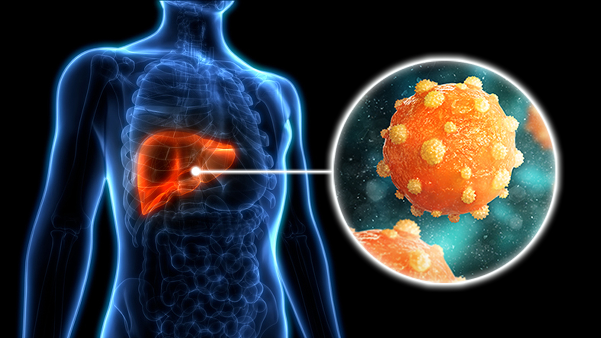  Image What is Hepatitis B